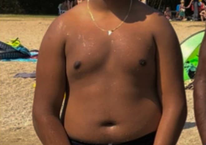 Before transformation